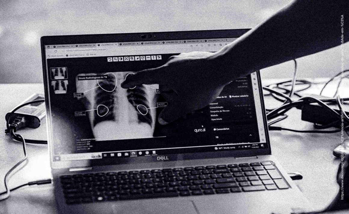 Moçambique usa Inteligência Artificial para combater tuberculose